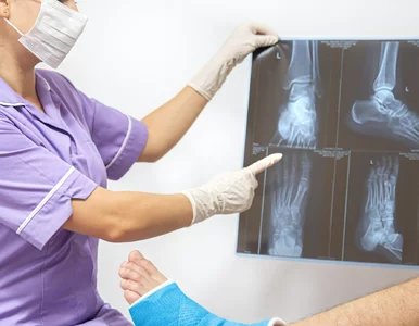 Miniatura: Zimą kości łamią się częściej niż myślisz....