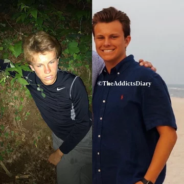 Zdjęcie przed i po wyjściu z nałogu 