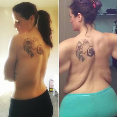 Miniatura: Kobieta schudła ponad 120 kg. Bierze...