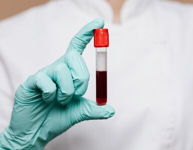 Miniatura: Mniej wolnych dni. Oddawanie krwi już nie...