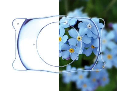 Miniatura: Trwała korekcja bardzo wysokich wad...