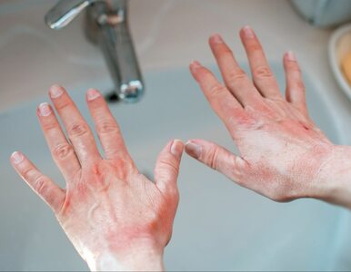 Co wygląd dłoni mówi o naszym stanie zdrowia?