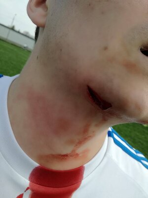 Miniatura: Zaatakowany zawodnik LKS-u Ciechów