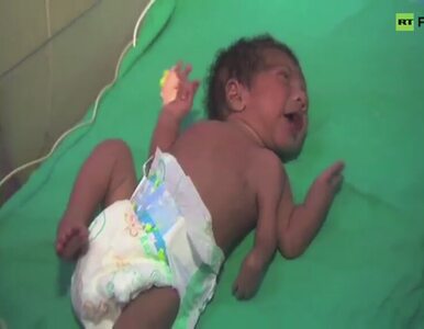 Miniatura: W Indiach urodziło się dziecko z 3 rękami