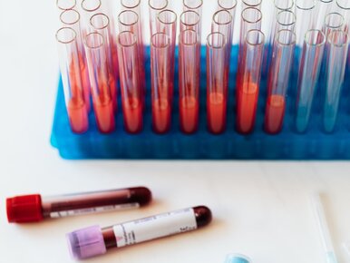 Miniatura: Testuj. Lecz. Zapobiegaj. Wczesna diagnoza...