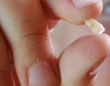 Miniatura: W Hiszpanii znaleziono ząb 10-latka...
