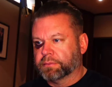 Miniatura: Znany muzyk poważnie ranny. Działał w...