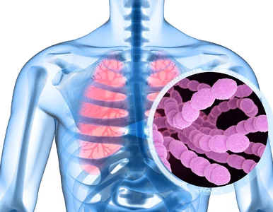 Miniatura: Pneumokoki – objawy, jak dochodzi do...