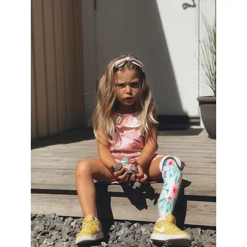 Penny po amputacji lewej nogi 