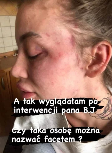 Zdjęcia opublikowane na InstaStory przez Klaudię Stec 