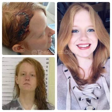 Zdjęcie przed i po wyjściu z nałogu 