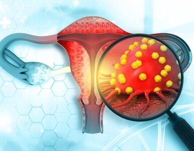 Czy przerost endometrium świadczy o raku? Jak wykryć raka endometrium?