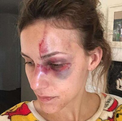 Miniatura: Melissa Gentz - studentka pobita przez...