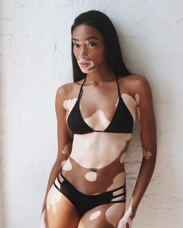 Winnie Harlow 