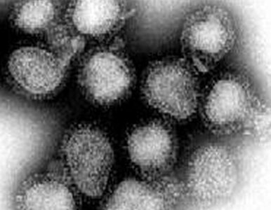 Miniatura: Odnaleziono fiolki z wirusem czarnej ospy