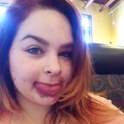 Miniatura: Miała dość pytań o to, czy została pobita....