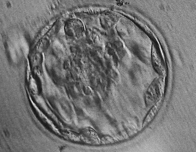 Miniatura: Naukowcy sklonowali zarodek człowieka....