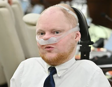 Miniatura: Krasoń o eksperymentalnym leczeniu: Te...