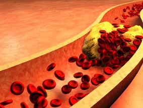 Miniatura: Kardiolog o&nbsp;mitach związanych...