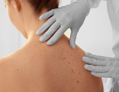 Badanie dermatologiczne – jak przebiega i kiedy warto je wykonać?