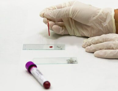 Miniatura: Badanie krwi jako metoda „wykrywania”...