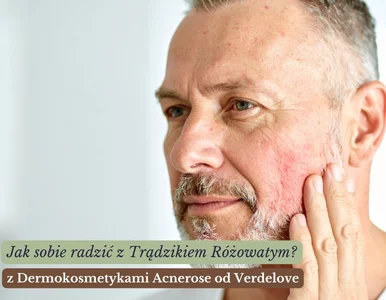 Miniatura: Trądzik różowaty – rozpoznanie, skuteczne...