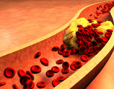 Miniatura: Jak obniżyć poziom cholesterolu? Wystarczy...