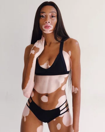 Winnie Harlow 