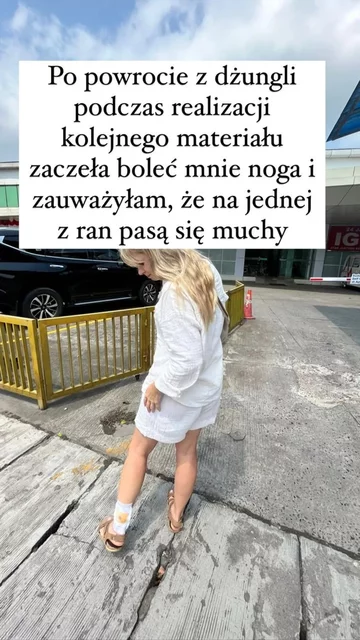 Marzena Figiel-Strzała pokazała ranę 