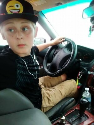 Miniatura: Trenton McKinley przed oraz po wypadku