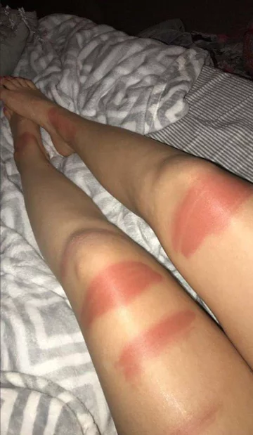 Podarte spodnie i słońce. Oto efekt 