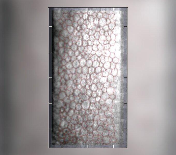 Śr&oacute;dbłonek rog&oacute;wki prawidłowy