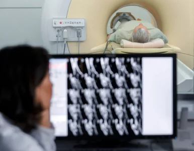 Miniatura: Limity w medycynie nuklearnej to bariery...