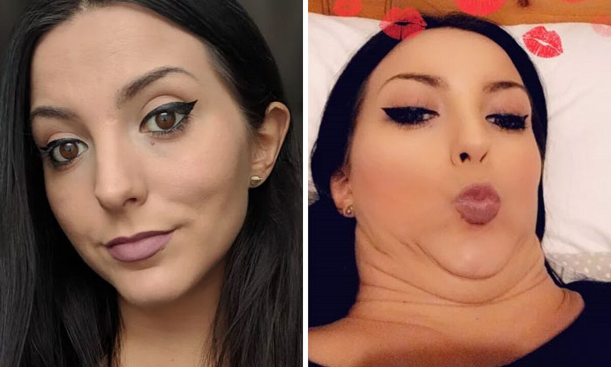 Kobiety pokazują tzw. zdjęcia „przed i po” 