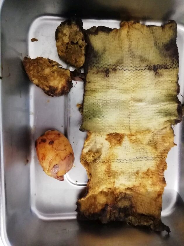 Podczas operacji z organizmu psa usunięto m.in. ziemniaka i ścierkę 
