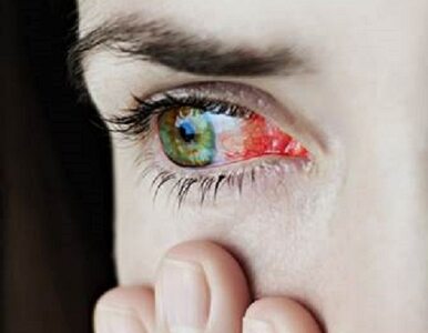 Czerwone oczy po przebudzeniu – możliwe przyczyny