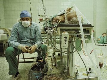 Prof. Zbigniew Religa po&nbsp;trwającej 23 godziny udanej operacji przeszczepu serca przeprowadzonej w&nbsp;1987&nbsp;r. Zdjęcie wykonał James L. Stanfield z&nbsp;National Geographic