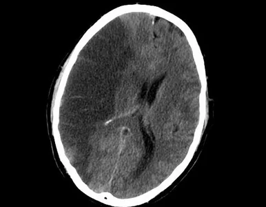 Miniatura: Do końca roku trwa konkurs na projekty...