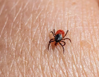 Miniatura: Wylęgarnia kleszczy w Twoim domu? Ekspert...