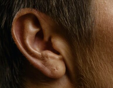 Miniatura: Ten niepozorny znak na uchu może być...