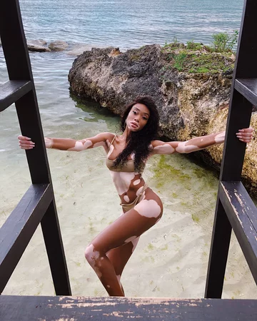 Winnie Harlow 