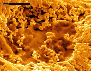 Miniatura: Przełom w nauce. Odkryto bakterie, które...