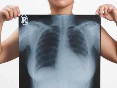 Miniatura: Interpretacja przepisów decyduje o życiu...