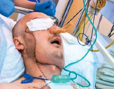 Miniatura: Wyszliśmy z tego z twarzą