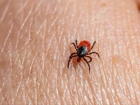 Miniatura: Kleszcz wbił się w skórę? Tego pod żadnym...