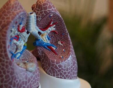 Miniatura: U ilu osób zdiagnozowano raka płuc w...