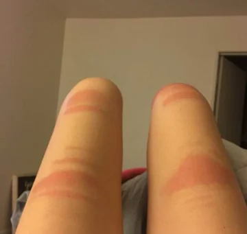 Podarte spodnie i słońce. Oto efekt 