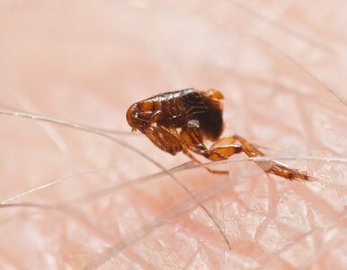 Miniatura: „Czarna śmierć” nie odeszła na zawsze....