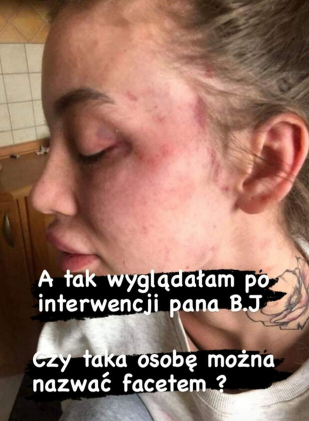 Zdjęcia opublikowane na InstaStory przez Klaudię Stec 