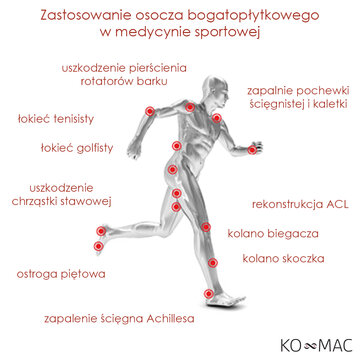 Zastosowanie osocza bogatopłytkowego w&nbsp;medycynie sportowej